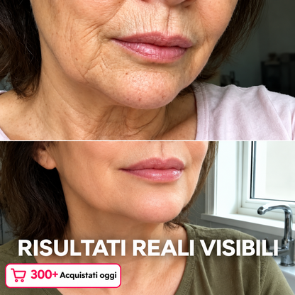 Stick Rimpolpante al Bio-collagene e PDRN