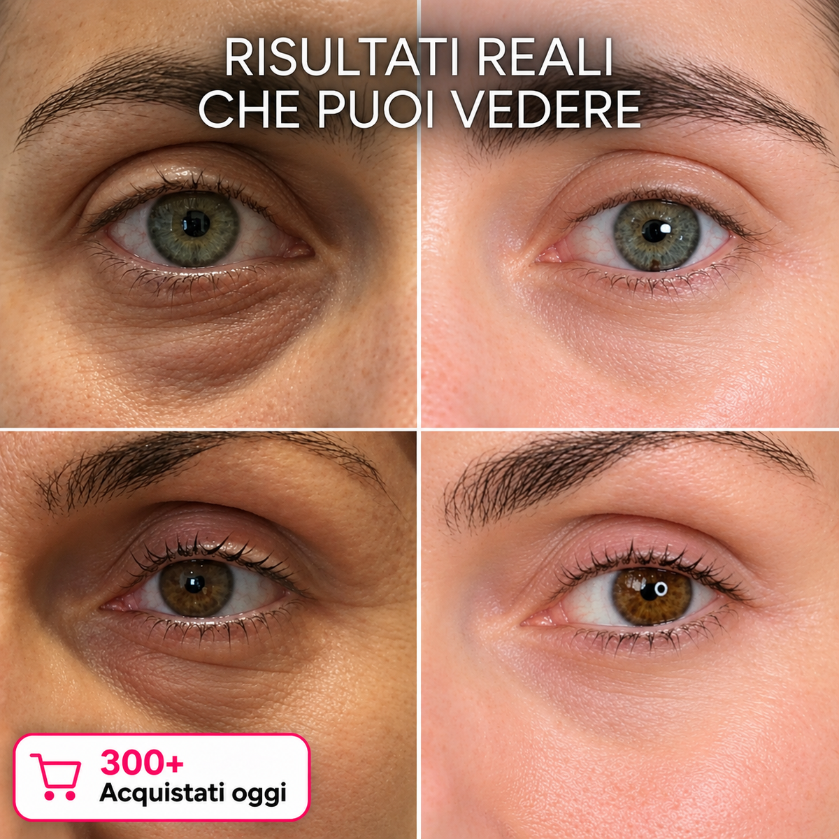 Stick Rimpolpante al Bio-collagene e PDRN