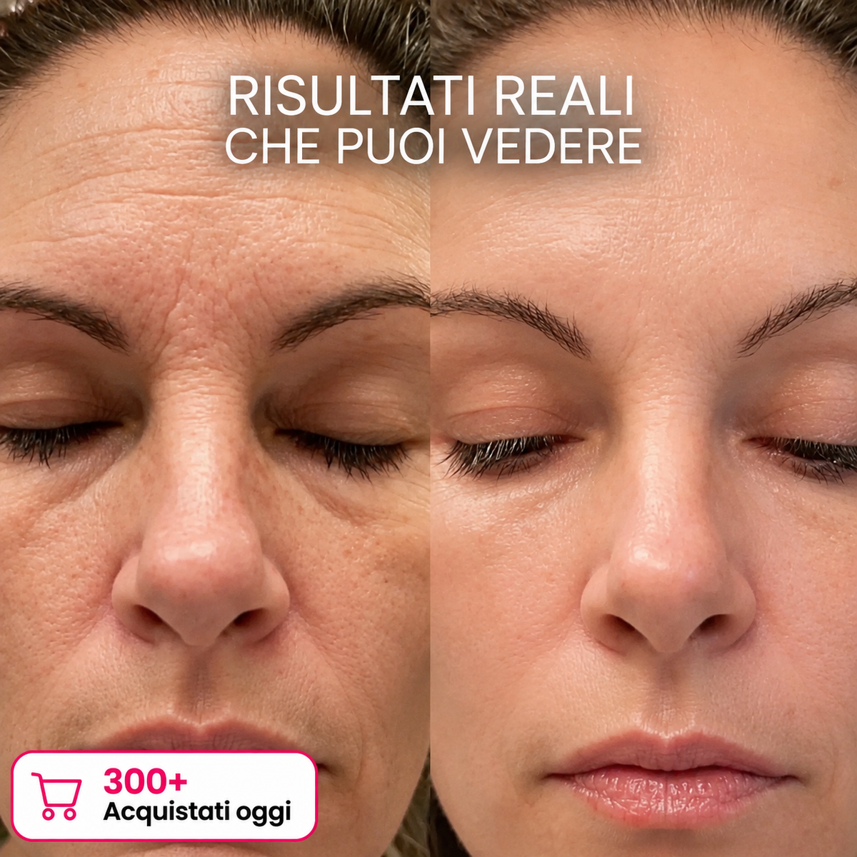 Stick Rimpolpante al Bio-collagene e PDRN