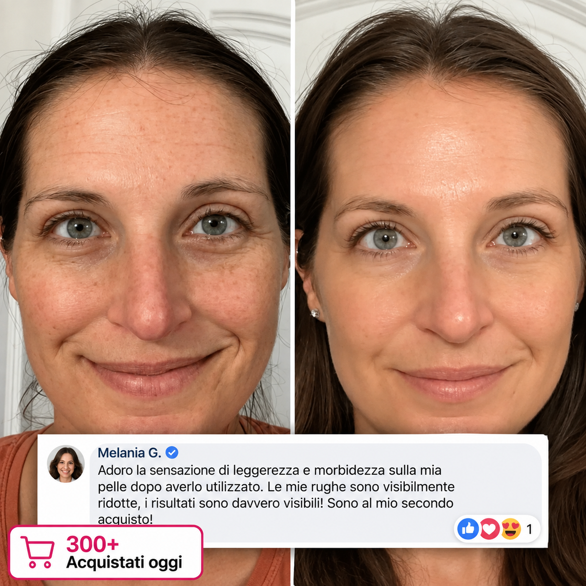 Stick Rimpolpante al Bio-collagene e PDRN