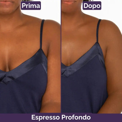 PellePerfetta™ – Corpo Senza Imperfezioni