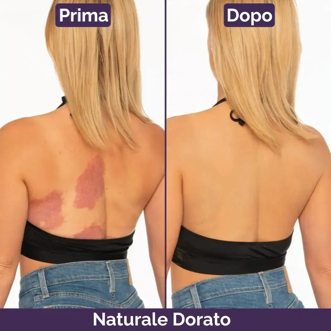 PellePerfetta™ – Corpo Senza Imperfezioni